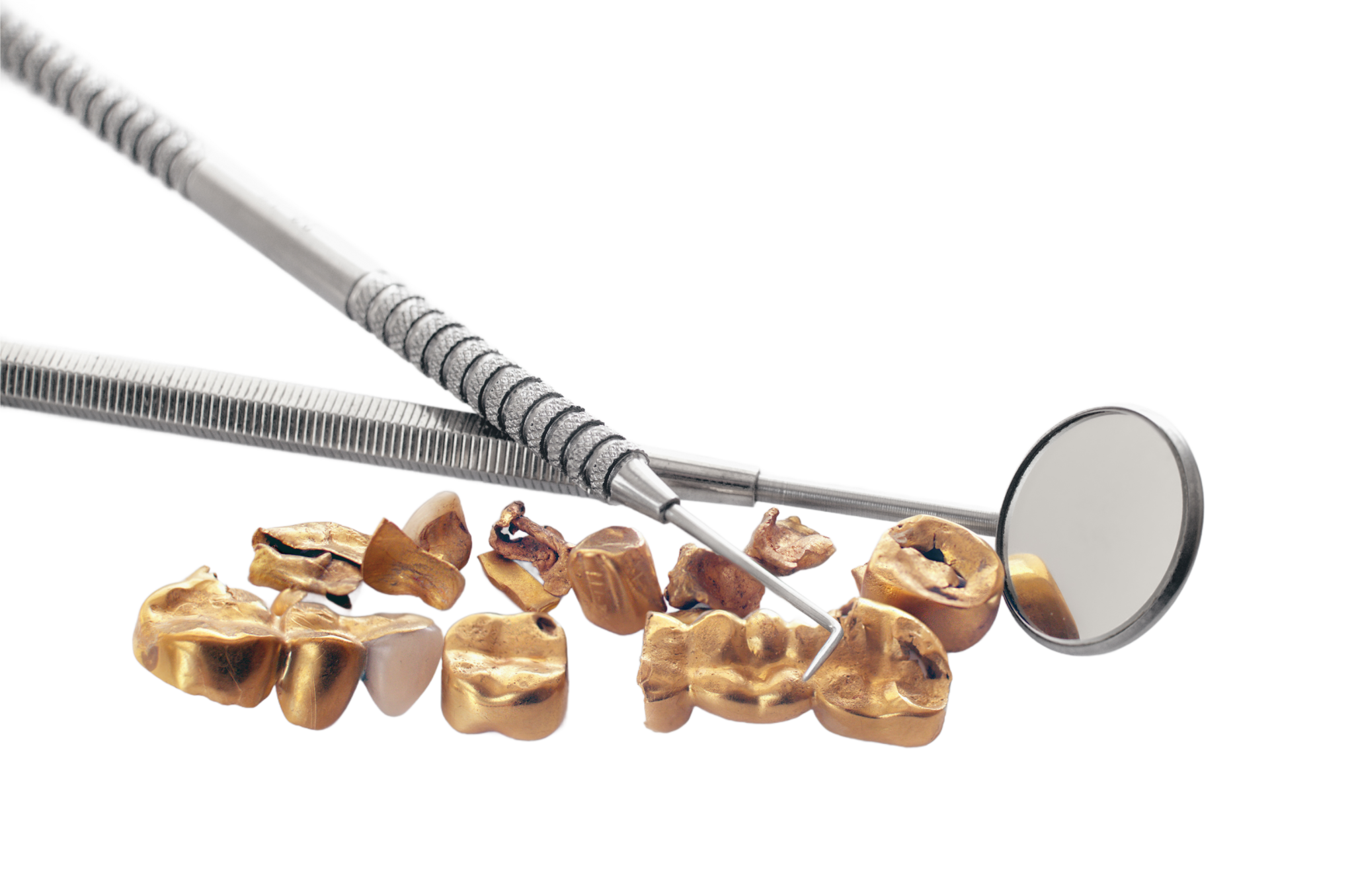 shutterstock_309275003_edited-dental-gold